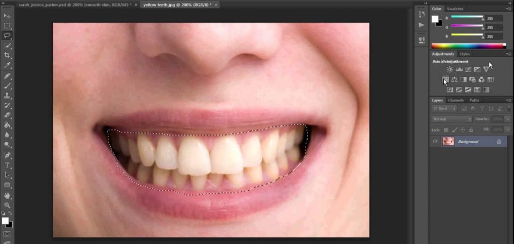 [:hu]Fogfehérítés, avagy melyik a nyerő a fogorvos vagy a photoshop?[:]